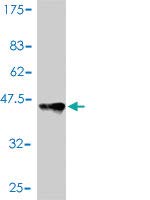 H00006921-А01 - Мишка поликлональные антитела срещу TCEB1 - Всяко (50 мл)